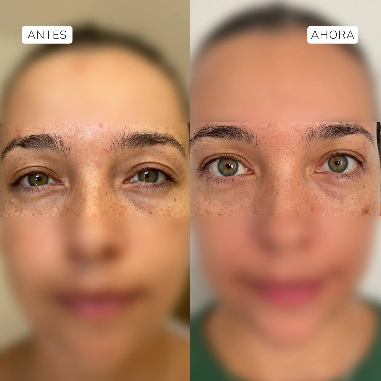 Complejo antiedad contorno de ojos