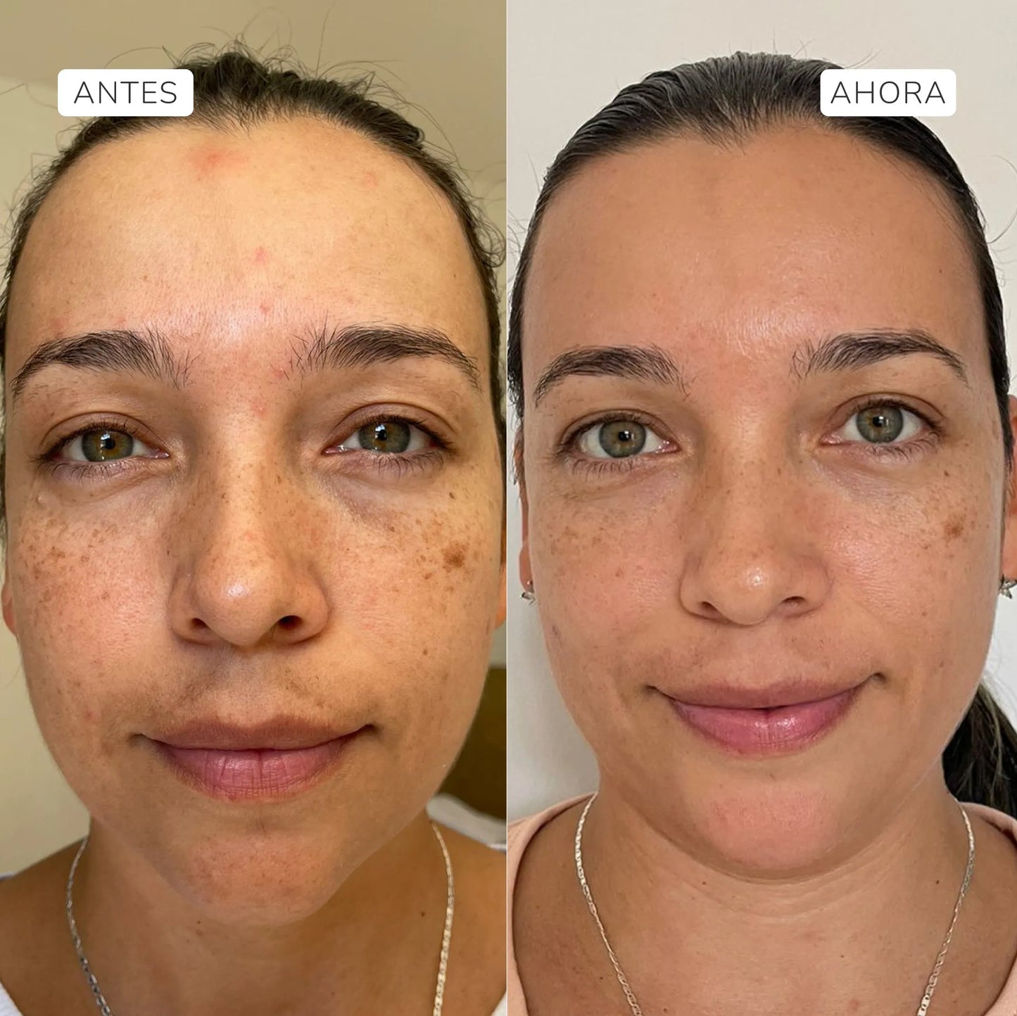 Serum facial intensivo Fitoretinol 30ml
