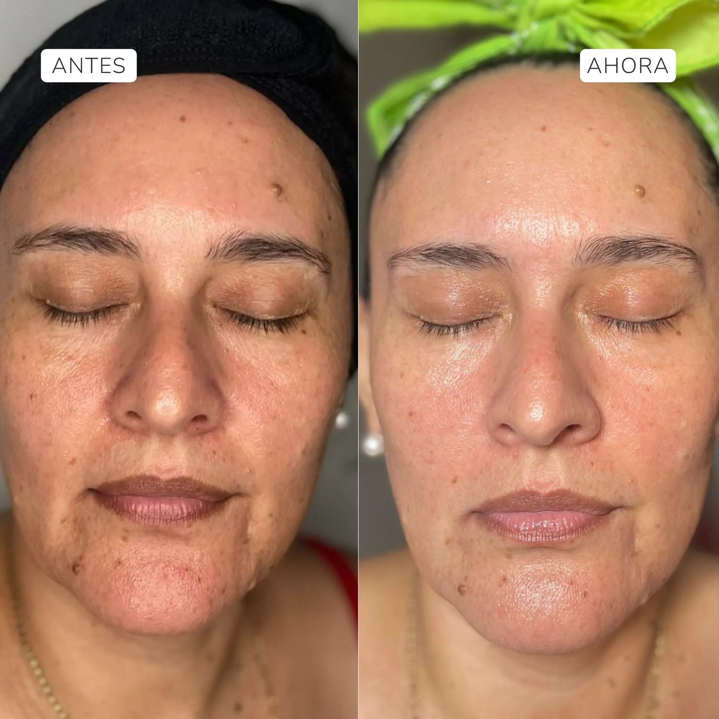 Serum Facial RevitaC 30ml - Vitamina C- Aruná