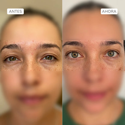 Complejo antiedad contorno de ojos