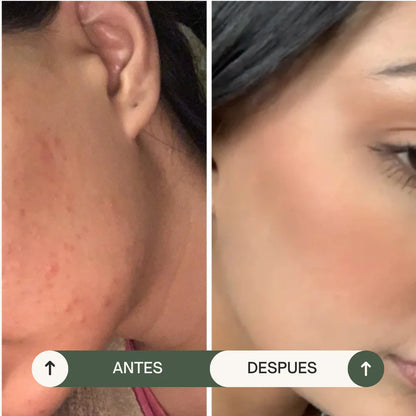 Jabón Anti-acné Arbol de té y jojoba - Amada Botánica